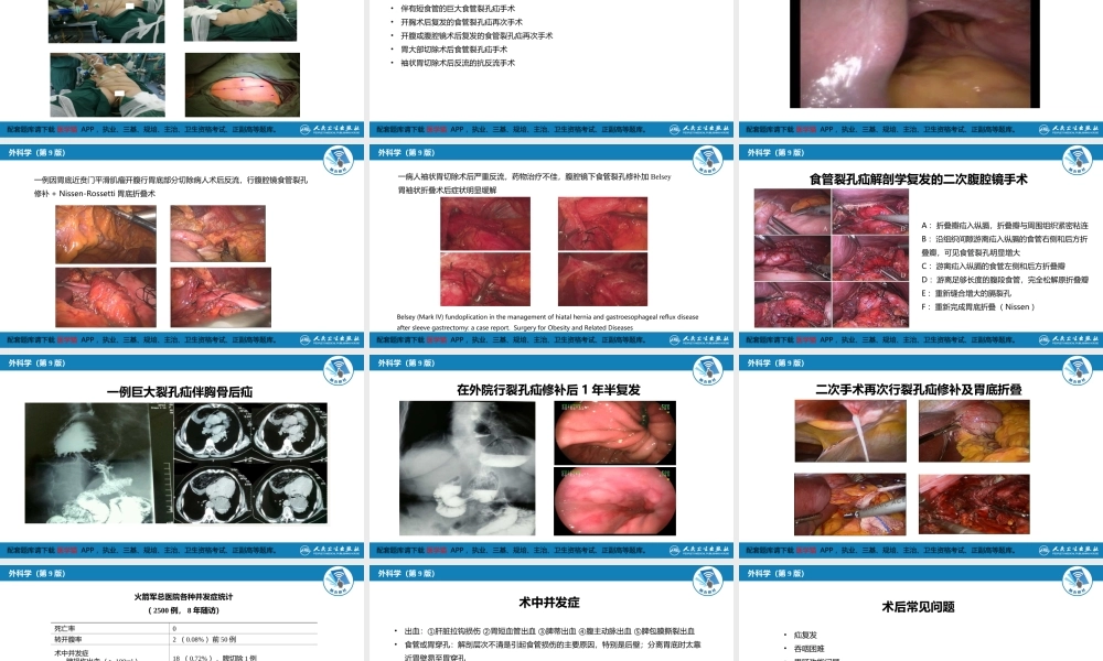 第二十七章 食管疾病 腹腔镜胃底折叠术技术要领(1).ppt