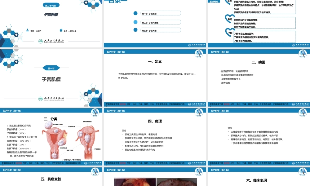 第二十六章 子宫肿瘤(1).ppt