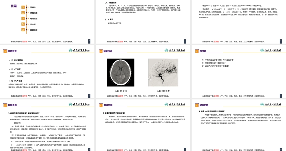 第二十章 案例分析-颅内动静脉畸形破裂导致的蛛网膜下腔出血(1).pptx