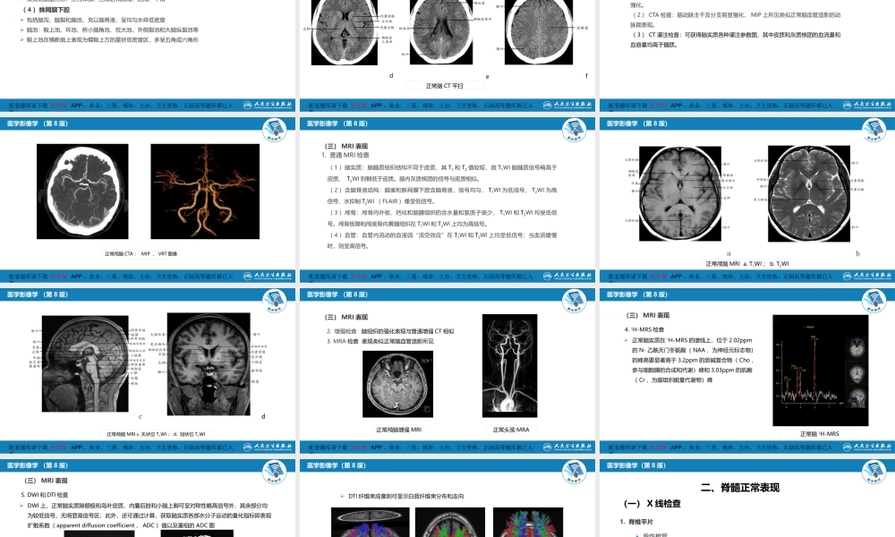 第二章 中枢神经系统 第二节 正常影像表现(1).pptx