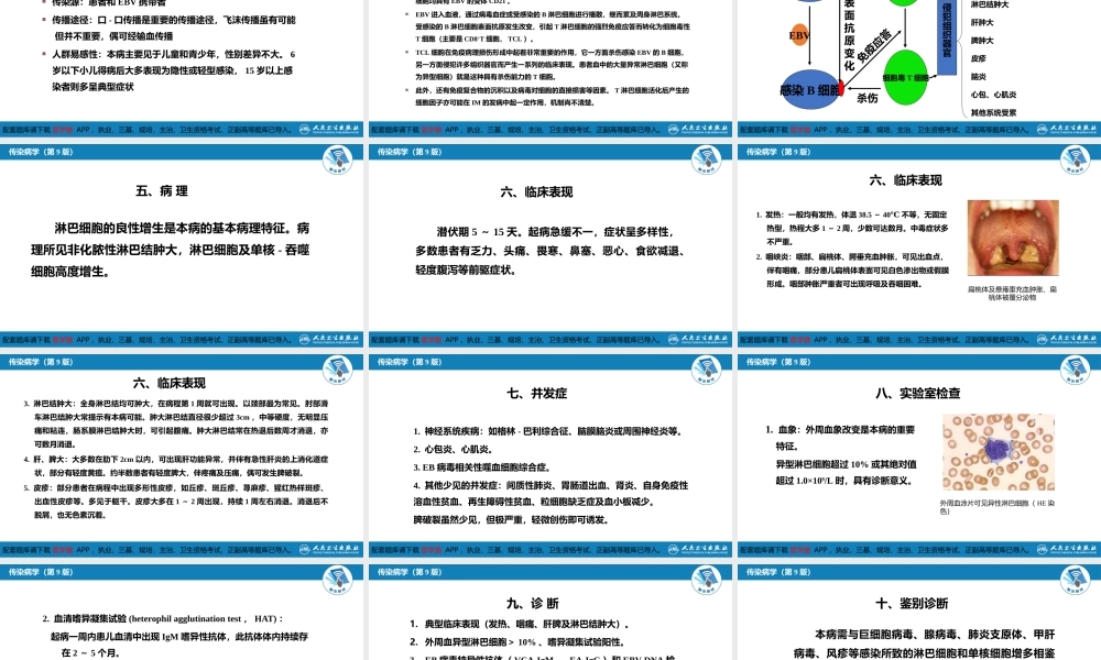 第二章 病毒性传染病 第十节 传染性单核细胞增多症(1).pptx