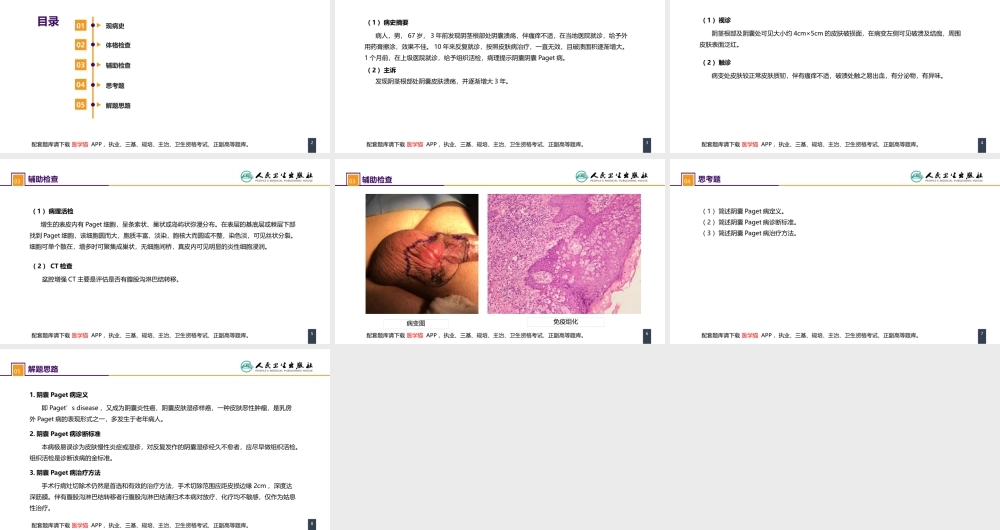 第五十三章 泌尿、男生殖系统肿瘤 案例分析-阴囊Paget病(1).pptx