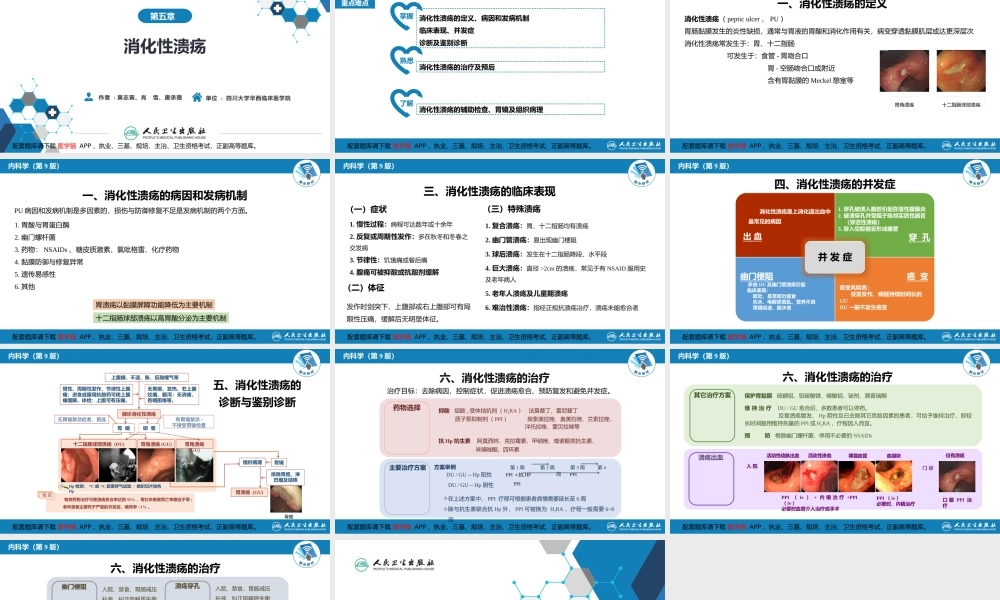 第五章消化性溃疡(1).pptx