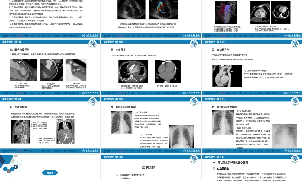 第五章 循环系统 第三节 基本病变表现；第四节 疾病诊断(1).pptx