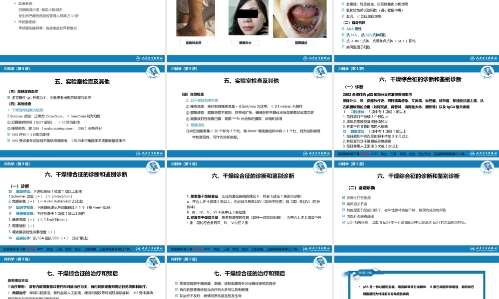 第八章 干燥综合征(1).ppt