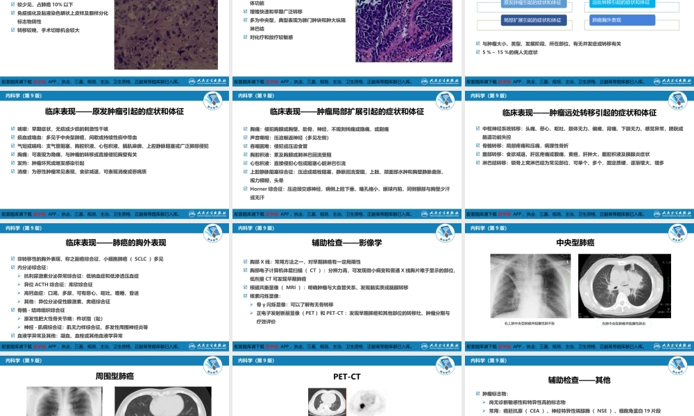 第八章肺癌(1).pptx