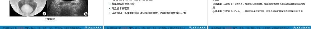 第八章 泌尿生殖系统与腹膜后间隙 第一节 泌尿系统(1).pptx