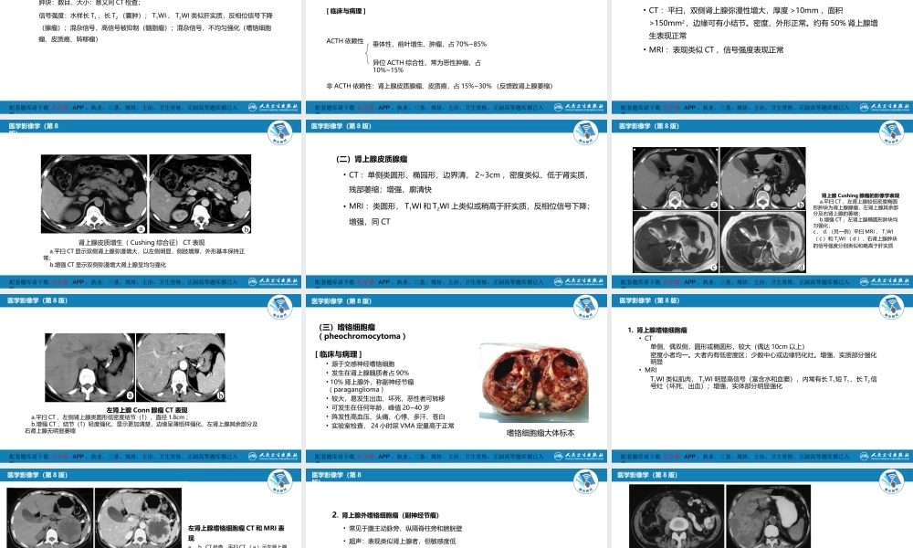 第八章 泌尿生殖系统与腹膜后间隙 第二节 肾上腺(1).pptx