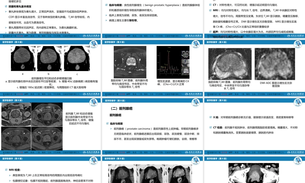 第八章 泌尿生殖系统与腹膜后间隙 第四节 男性生殖系统(1).pptx