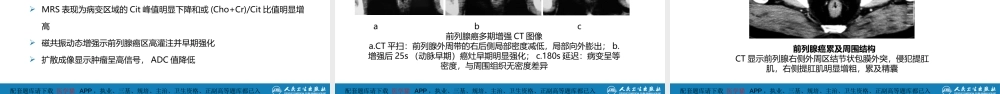 第八章 泌尿生殖系统与腹膜后间隙 第四节 男性生殖系统(1).pptx