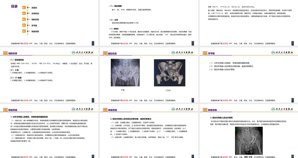 第六十三章 案例分析-髋臼骨折(1).ppt