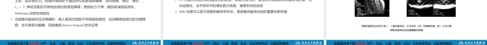 第六十七章 颈、腰椎退行性疾病 第一节 颈椎退行性疾病(1).pptx