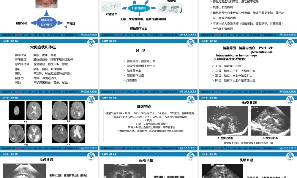第六章 新生儿与新生儿疾病 第六节 新生儿颅内出血(1).pptx