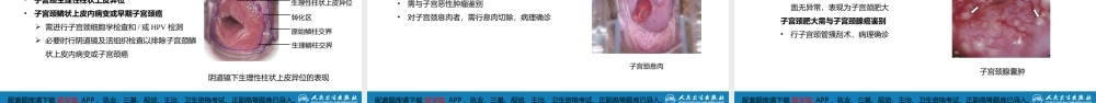 第十九章 子宫颈炎症.(1).pptx