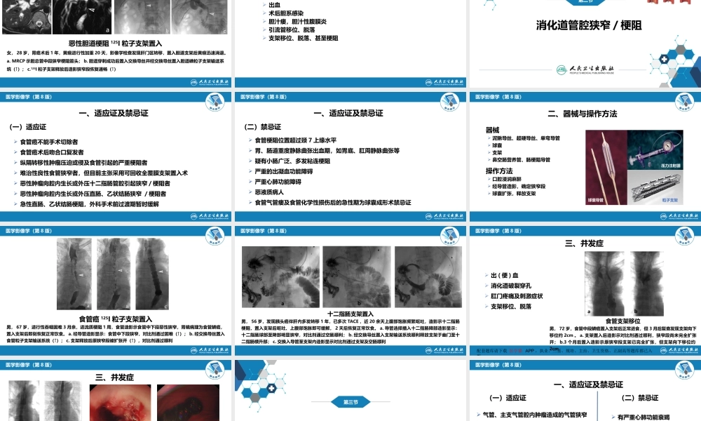 第十四章 非血管疾病介入治疗(1).pptx