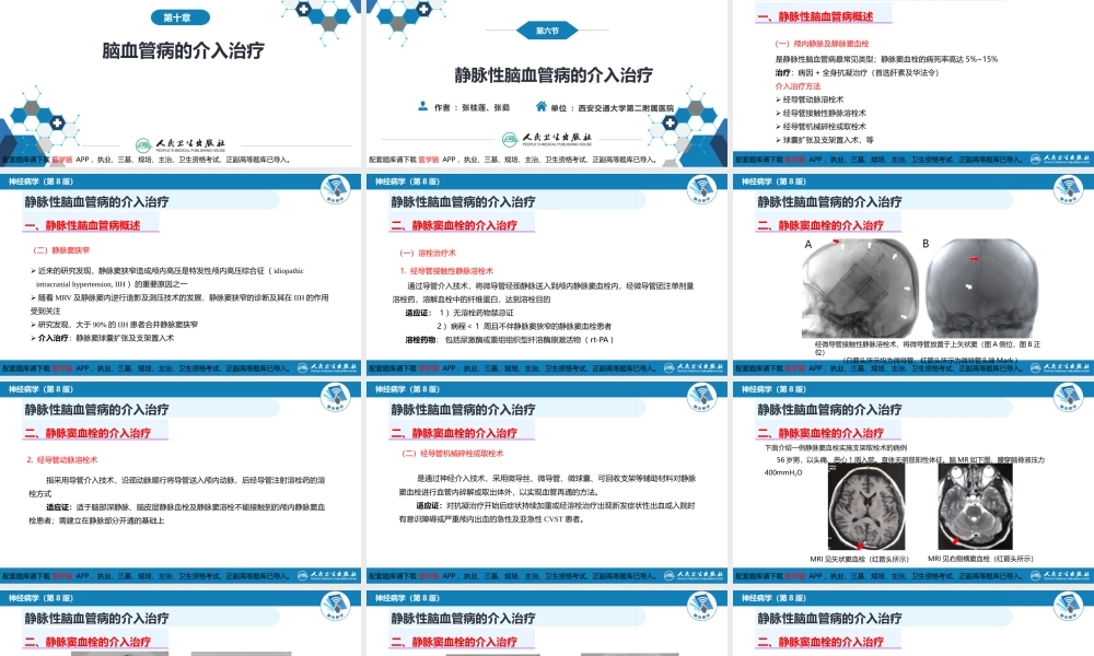 第十章 脑血管病的介入诊疗（3）(1).pptx