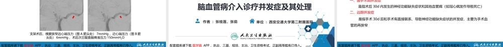 第十章 脑血管病的介入诊疗（3）(1).pptx