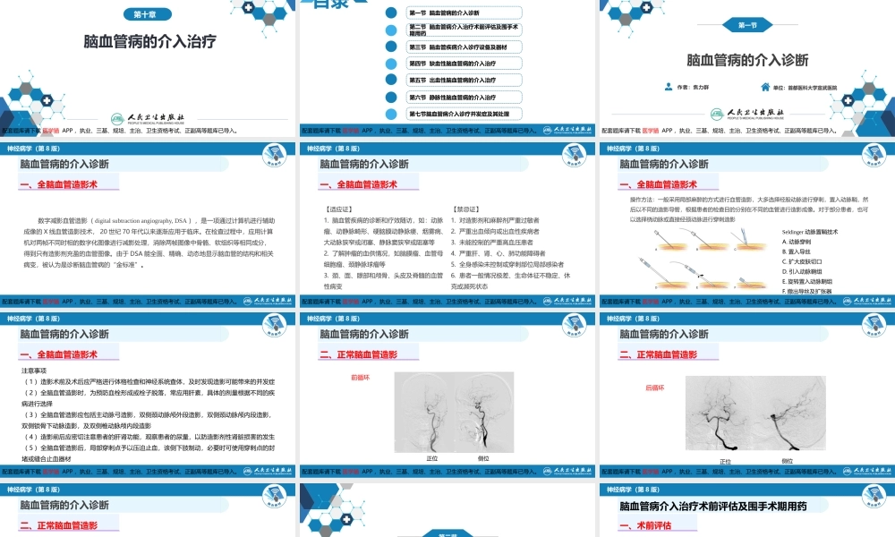 第十章 脑血管病的介入诊疗（1）(1).pptx