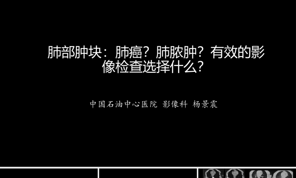 肺部肿块有效的影像检查选择(1).pptx