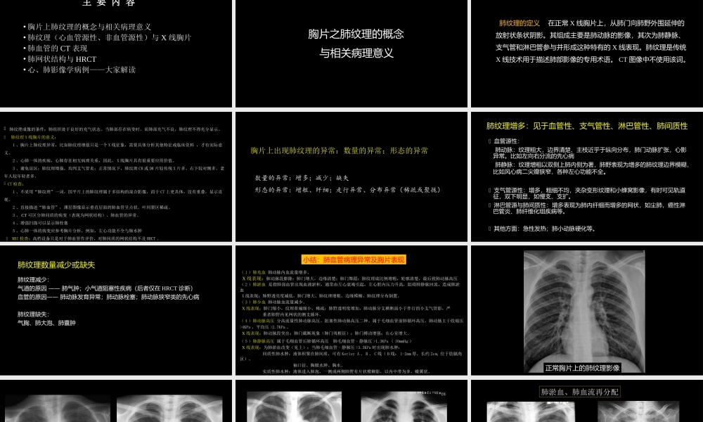 肺血管及肺网状结构影像学与心肺疾病-修改版(1).ppt