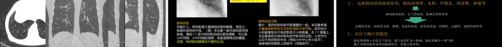 肺血管及肺网状结构影像学与心肺疾病-修改版(1).ppt