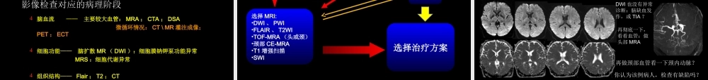脑缺血的CT、MR灌注成像(1).ppt