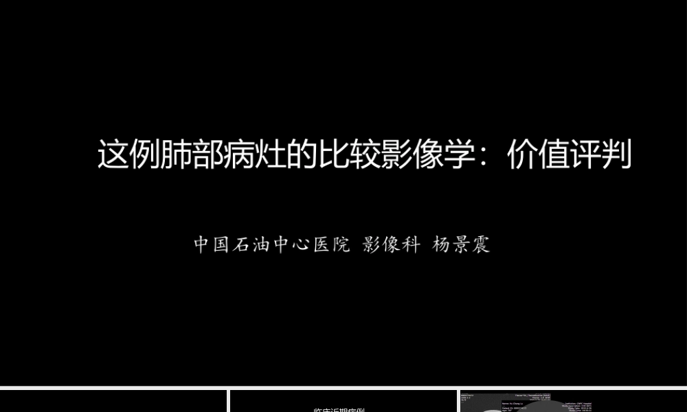 这例肺部病灶的比较影像学：价值评判(1).pptx