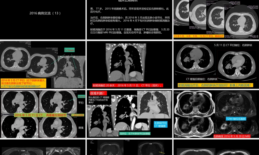 这例肺部病灶的比较影像学：价值评判(1).pptx