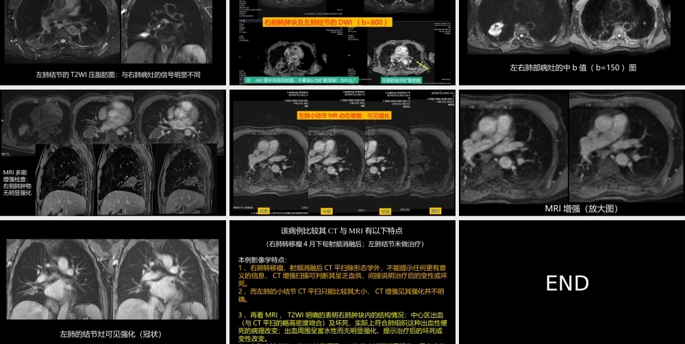 这例肺部病灶的比较影像学：价值评判(1).pptx