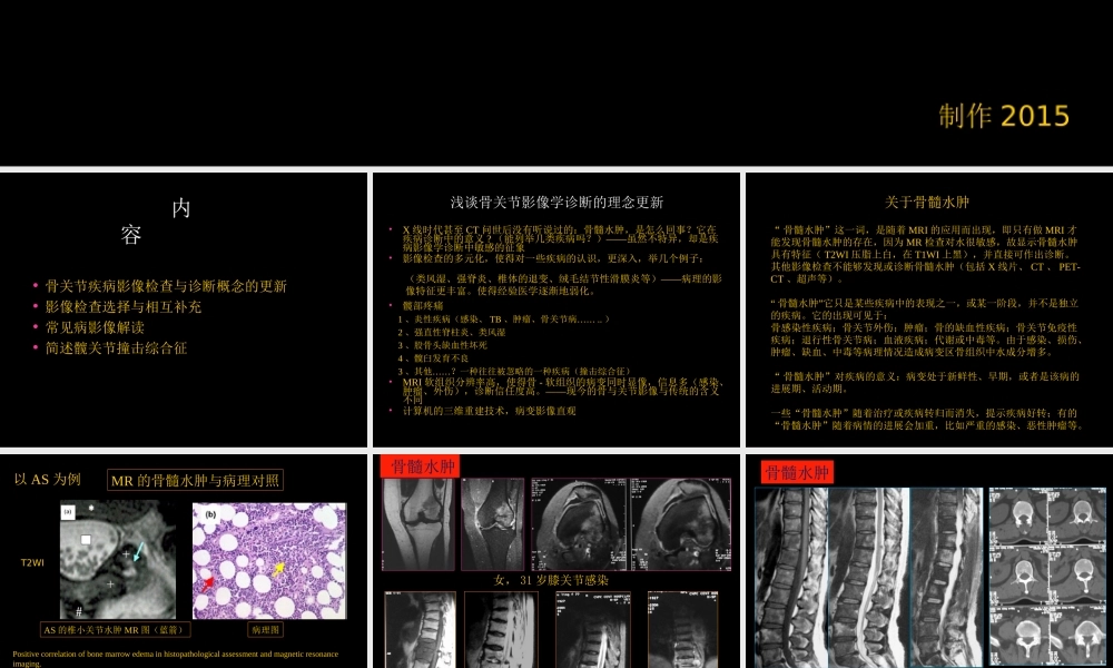 骨与关节常见病影像诊断(1).ppt