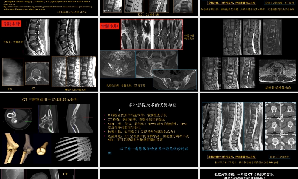 骨与关节常见病影像诊断(1).ppt