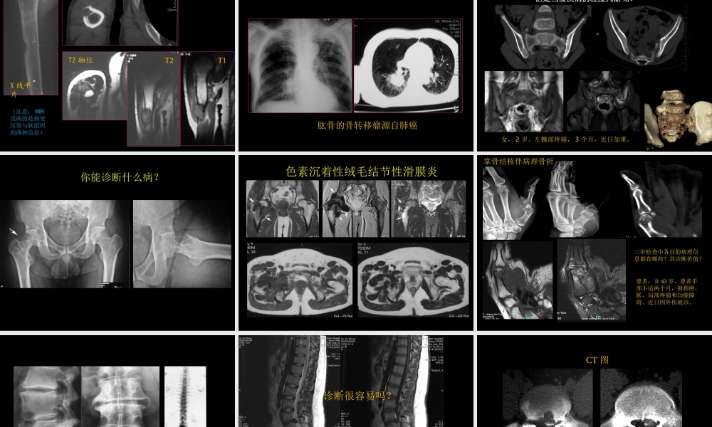 骨与关节常见病影像诊断(1).ppt