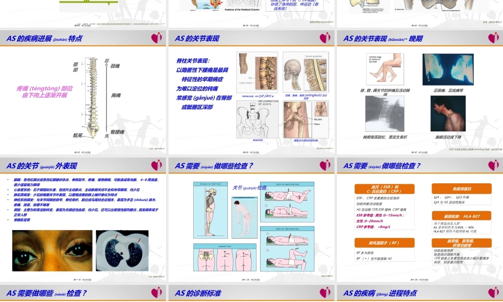 2022年医学专题—AS老患者患教PPT-终0626.ppt