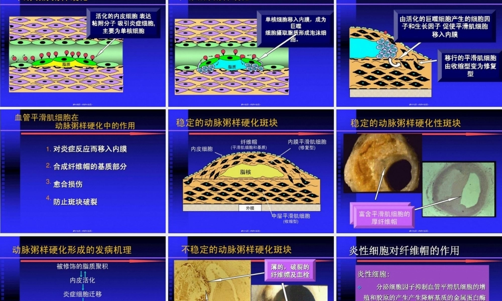 2022年医学专题—动脉粥样硬化幻灯片.ppt