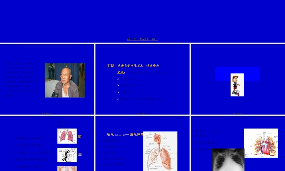 2022年医学专题—呼吸困难发绀.ppt