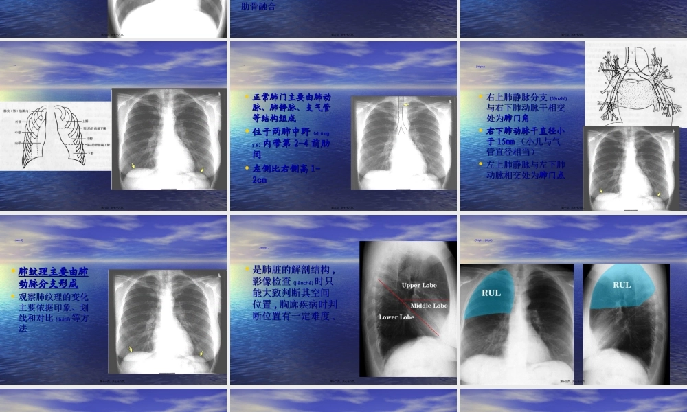 2022年医学专题—教你如何看肺部CT.ppt