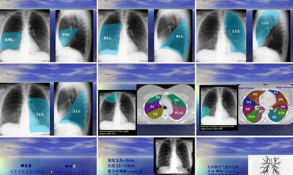 2022年医学专题—教你如何看肺部CT.ppt