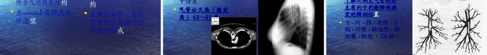 2022年医学专题—教你如何看肺部CT.ppt