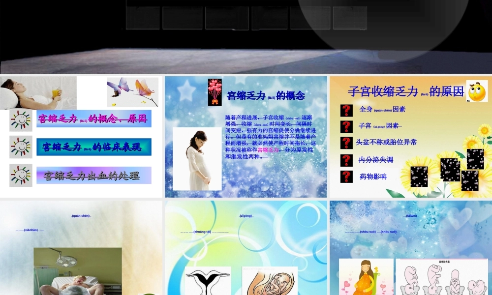 2022年医学专题—子宫收缩乏力性出血的处理.ppt