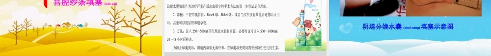 2022年医学专题—子宫收缩乏力性出血的处理.ppt