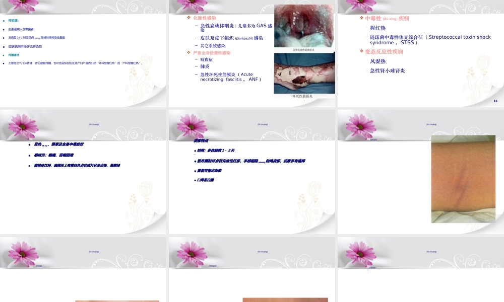 2022年医学专题—流感样病例、猩红热及不明原因肺炎相关知识.ppt