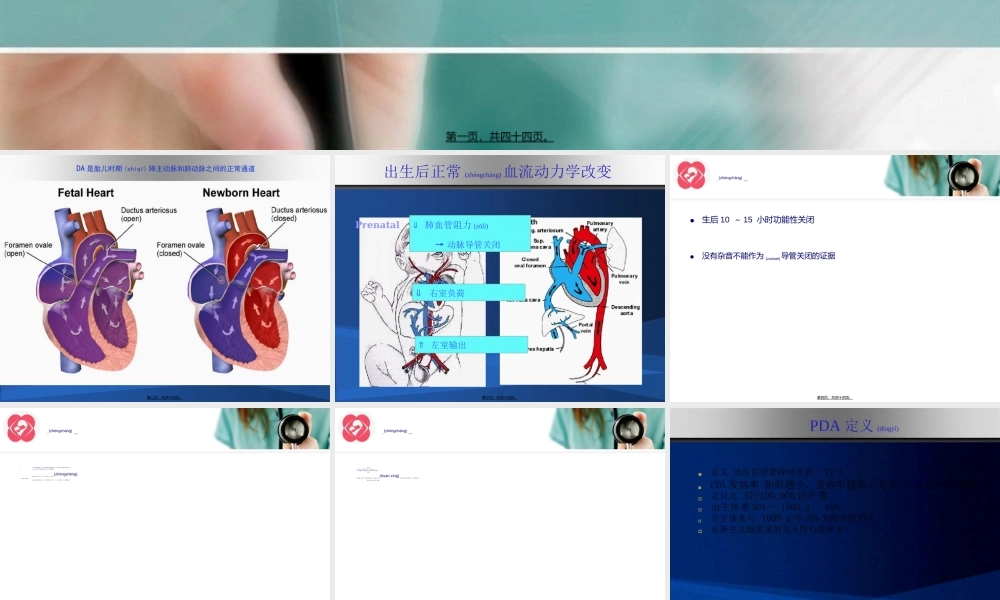 2022年医学专题—早产儿动脉导管开放.ppt