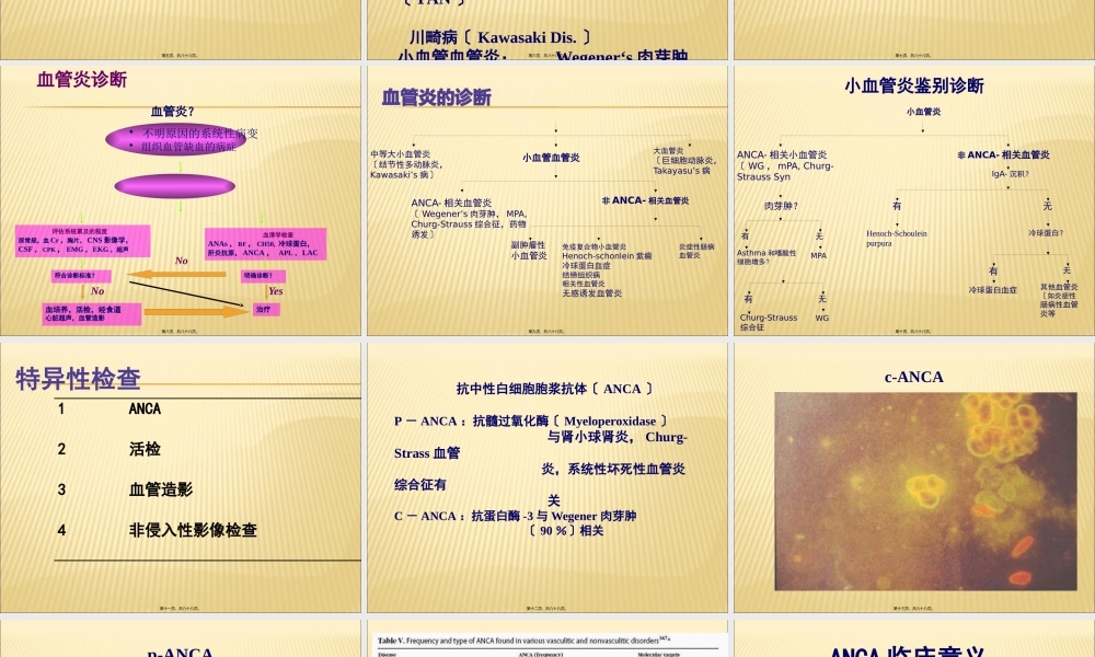 ANCA相关性血管炎诊治.pptx