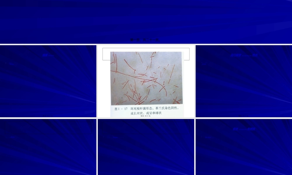 2022年医学专题—坏死杆菌病.ppt