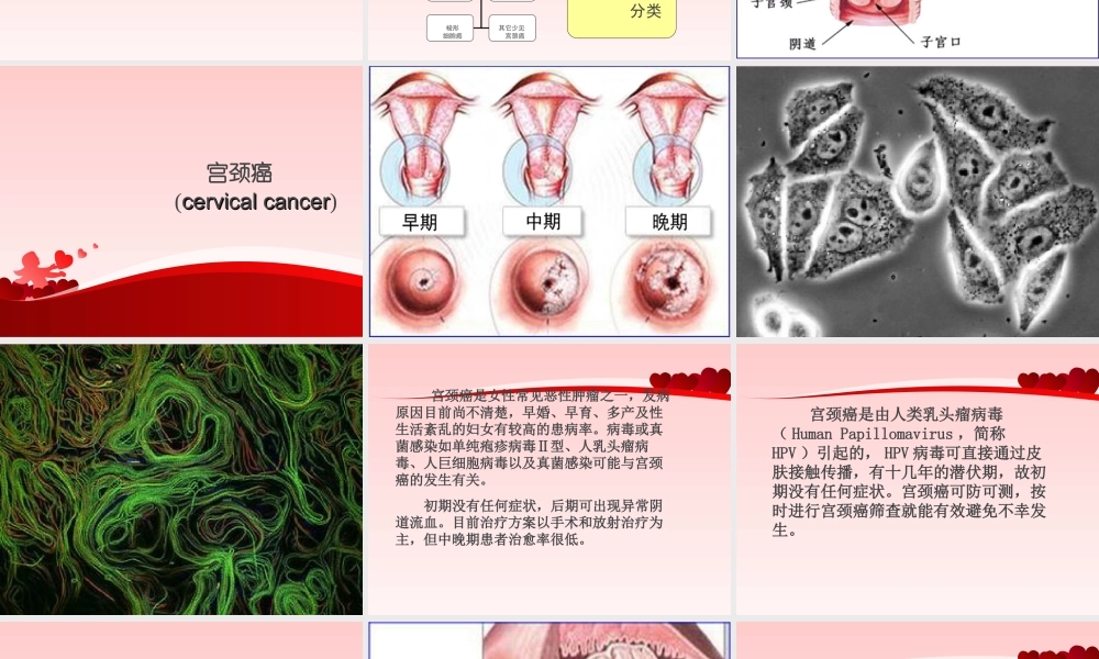 一种子宫癌筛查的新方法.ppt