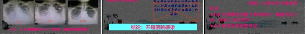 3月医院感染病例判断与分析.pptx