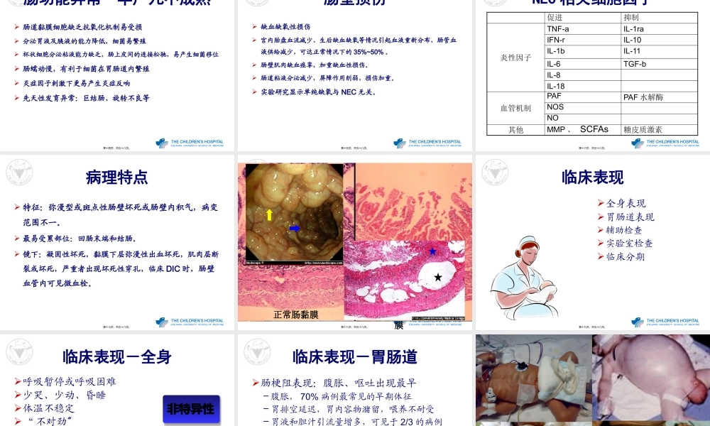 NEC(新生儿坏死性小肠结肠炎).pptx