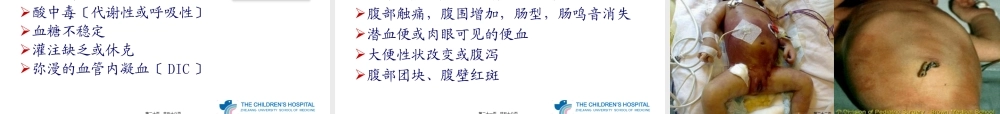 NEC(新生儿坏死性小肠结肠炎).pptx