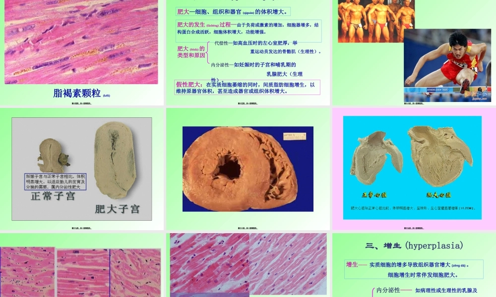 2022年医学专题—第一章--组织细胞的损伤(第七版).ppt