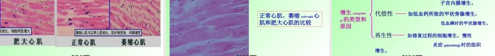 2022年医学专题—第一章--组织细胞的损伤(第七版).ppt
